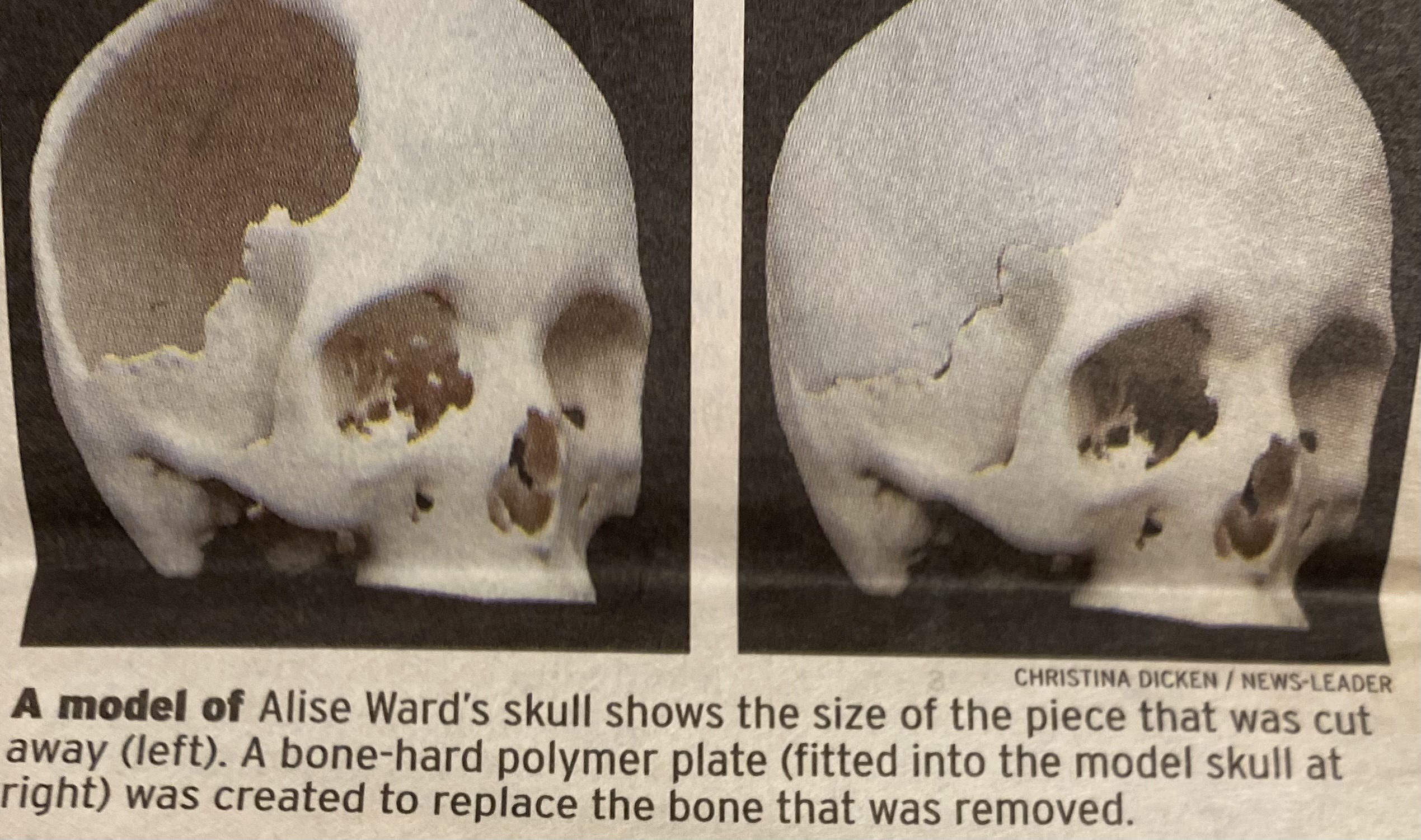 Skull (1)